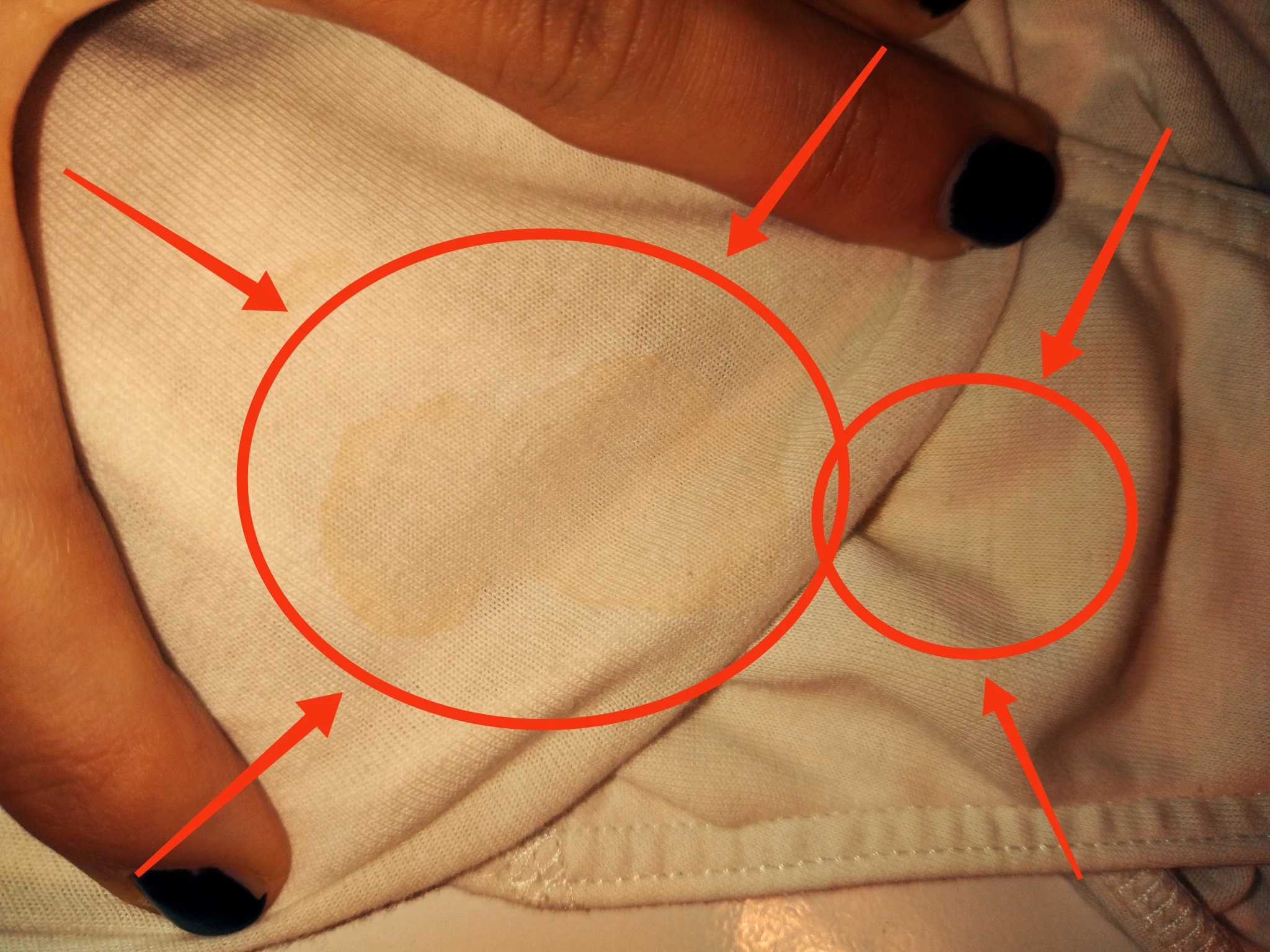 Stessa foto con le macchie cerchiate e frecciate